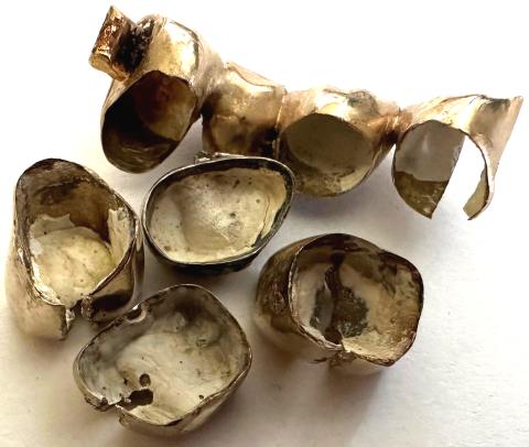 Ankauf Zahngold mit Resten