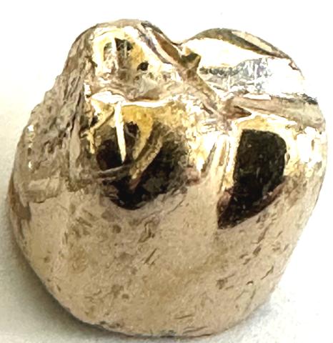 Zahngold Wert pro Gramm