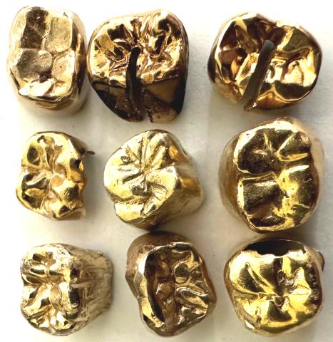 Zahngold verkaufen