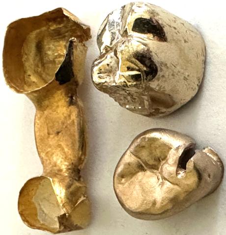 Zahngold Rechner