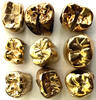 Zahngold Wert pro Gramm