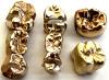 Zahngold verkaufen