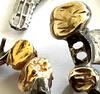 Zahngold Preis