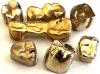 Zahngold Rechner