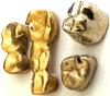 Zahngold Rechner